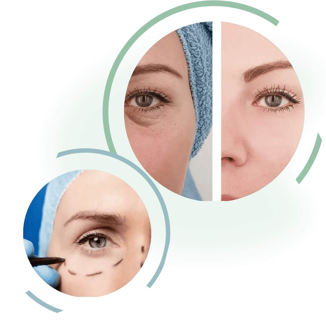 Post-Treatment Care and Complications