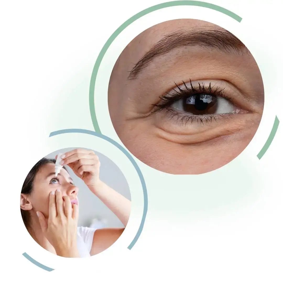 Miebo vs Other Eye Drops: A Comparison